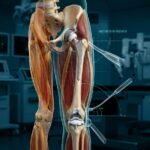 Human hip and knee prostheses 20261025175044 150x150