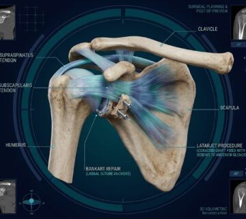 Shoulder anatomy medical visuali… 20261025175056 360x320